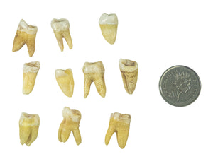 10 Human Molars (1351-11-G5000)