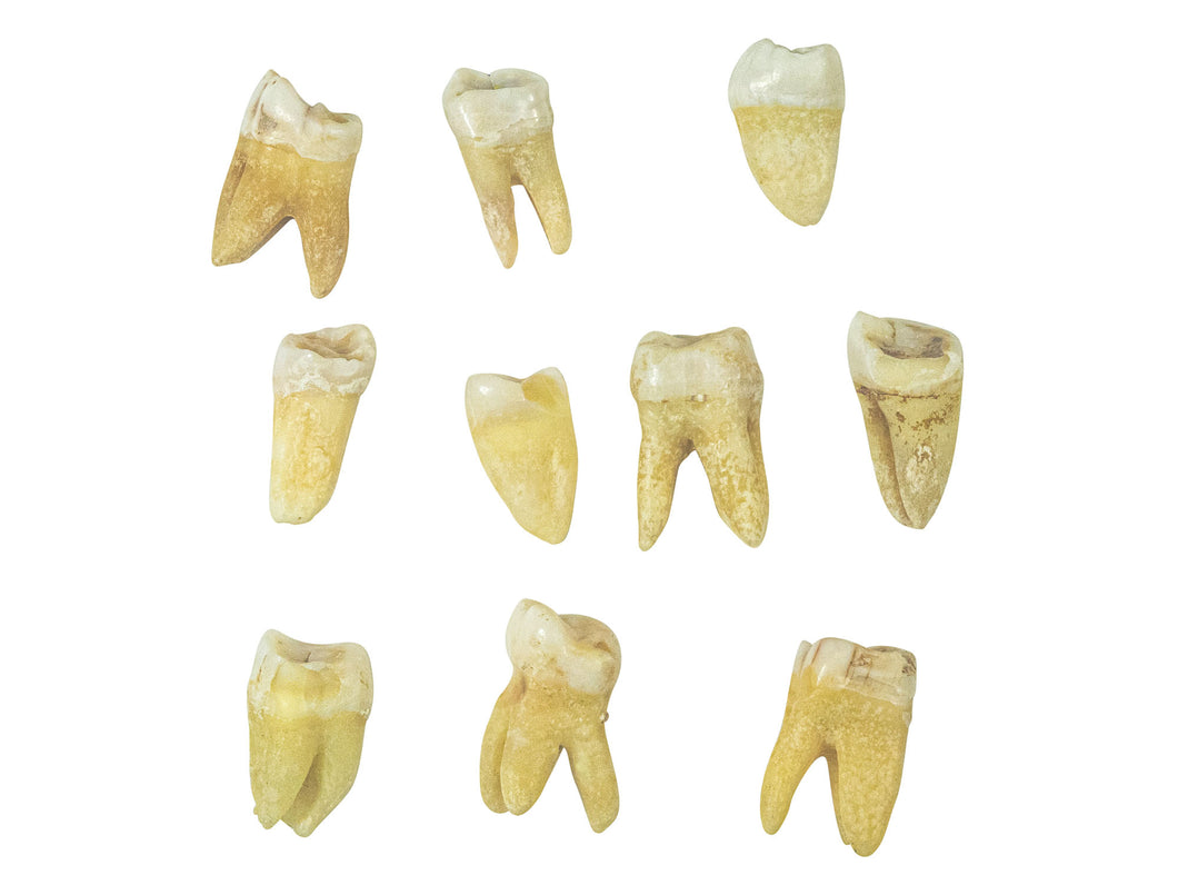 10 Human Molars (1351-11-G5000)