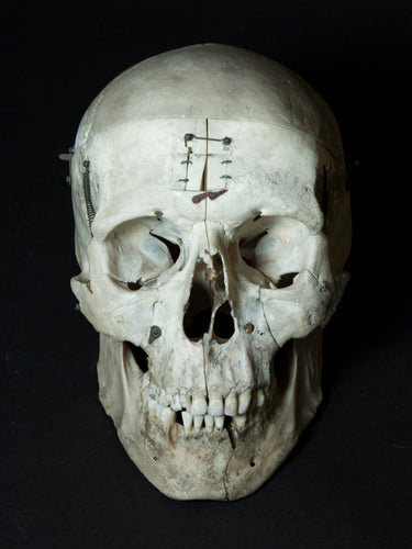 Human Skull with Articulations (15-254-G01)